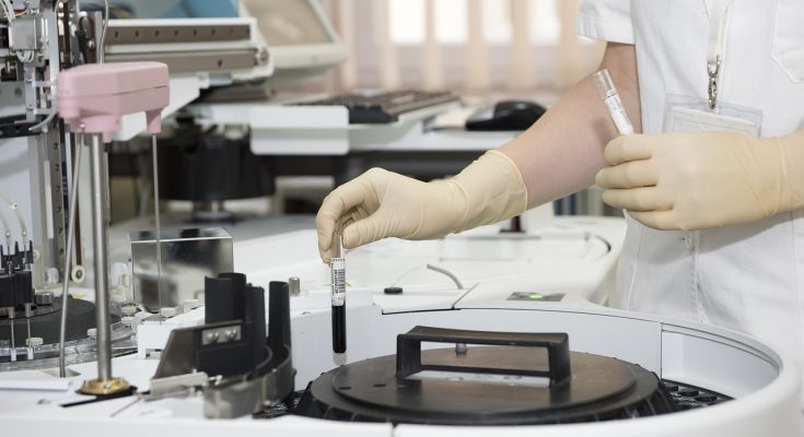Laboratory, test tubes, healthcare worker — A Simple Guide to Buying Cannabis Vaporizer