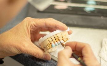 Tooth replacement, dentist, healthcare — Finding Cheap Dental Insurance Plans