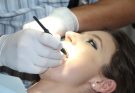 Teeth cleaning, tooth repairs, treat teeth — Negative Effects of Teeth Implants