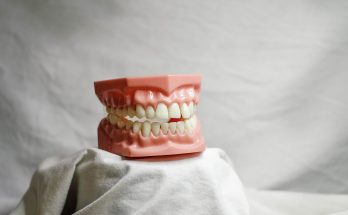 Teeth, dental, dental model — Oral Health