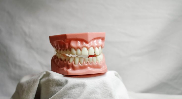 Teeth, dental, dental model — Oral Health